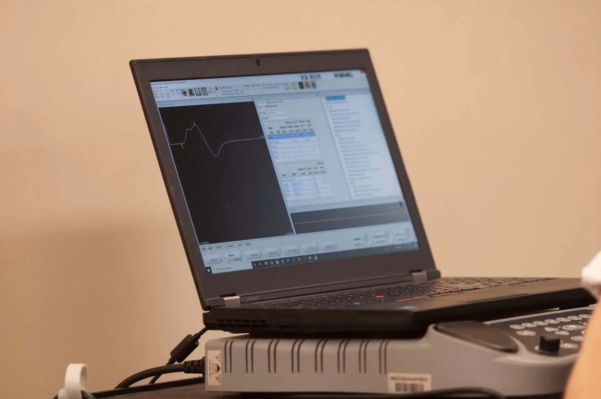 Taking the Mystery Out of an EMG/NCS Report – Part 2 - EMG Solutions