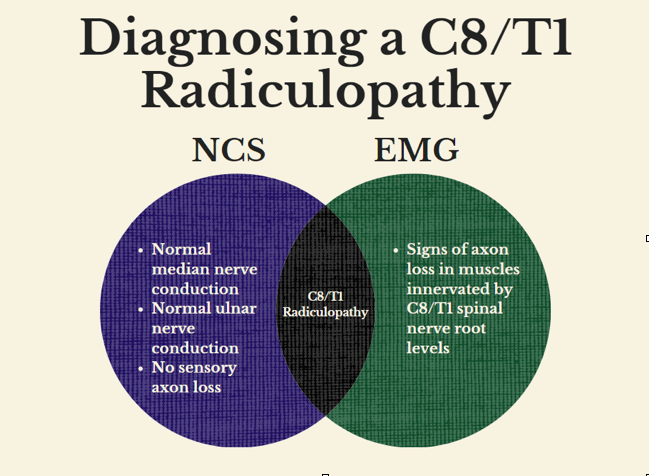 It Takes Two to Tango: Why EMG and NCS Always Go Together - EMG Solutions
